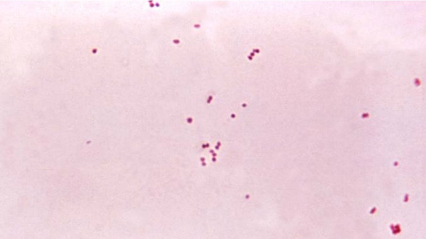 CDC meningitis Princeton.jpg